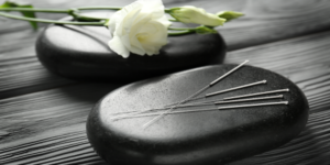 Acupuncture: Complementary Therapy Services
