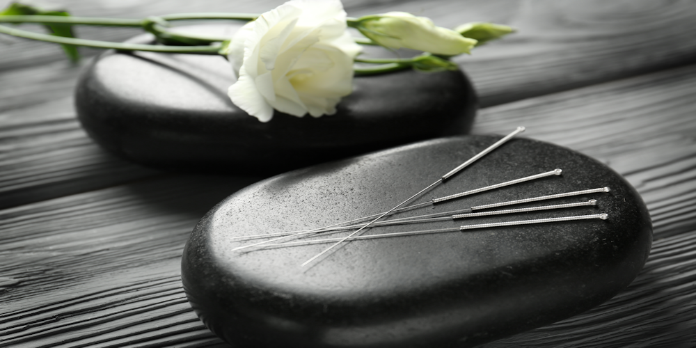 Acupuncture: Complementary Therapy